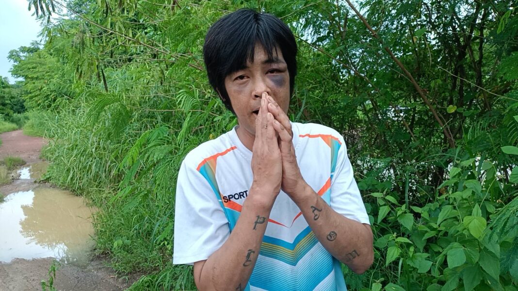 ปราจีนบุรี.- หนุ่มขายกบถูกน้ำซัดจมน้ำรอดตายหวุดหวิด ปราจีนบุรี.- หนุ่มขายกบถูกน้ำซัดจมน้ำรอดตายหวุดหวิด